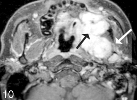 Fig 10.
