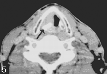Fig 5.
