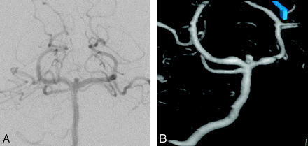 Fig 1.
