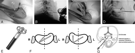 Fig 1.