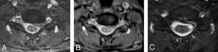 Fig 2.