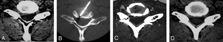 Fig 4.