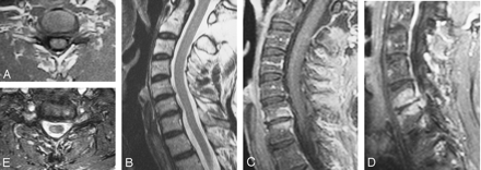 Fig 5.