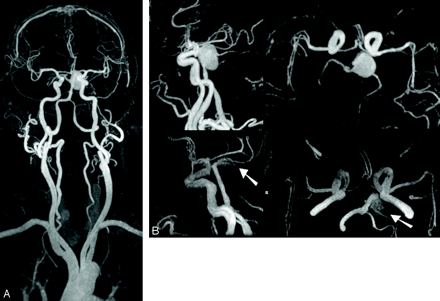 Fig 2.