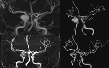 Fig 3.
