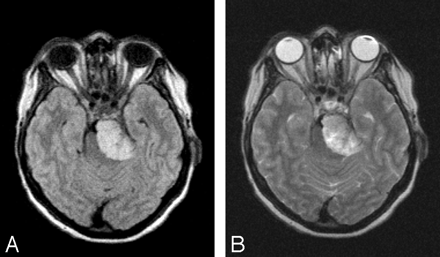 Fig 7.