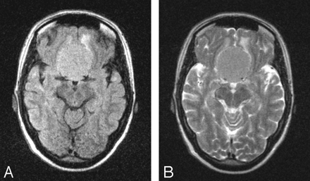 Fig 8.