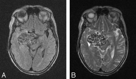 Fig 9.