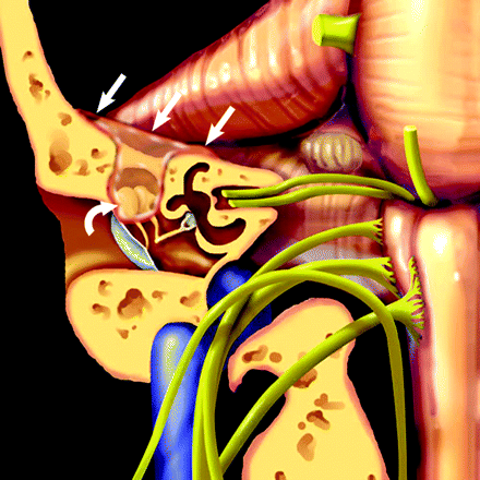 Fig 1.