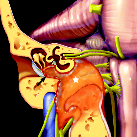 Fig 3.