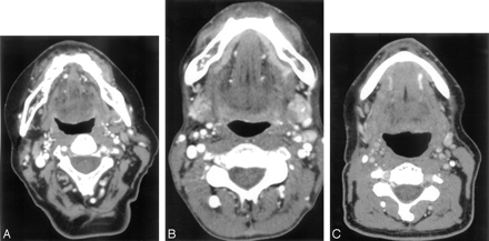 Fig 2.