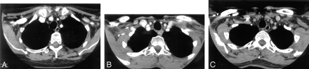 Fig 3.