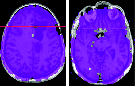   Fig 1. 