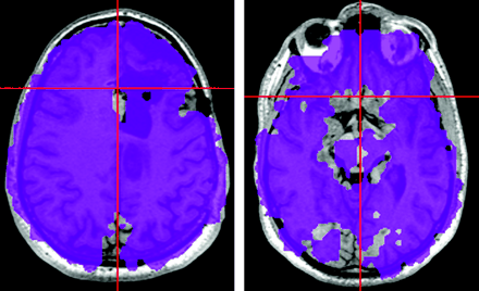   Fig 1. 