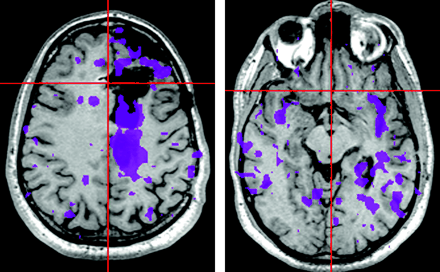   Fig 1. 