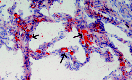 Fig 3.