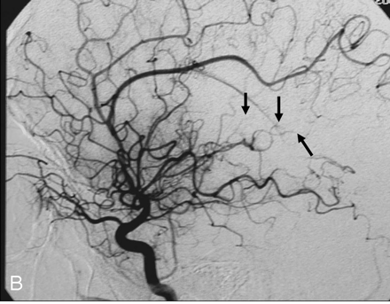 Fig 2.