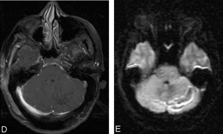 Fig 1.