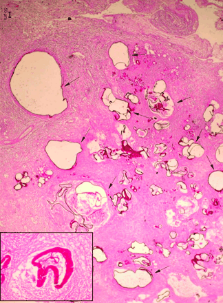 Fig 4.