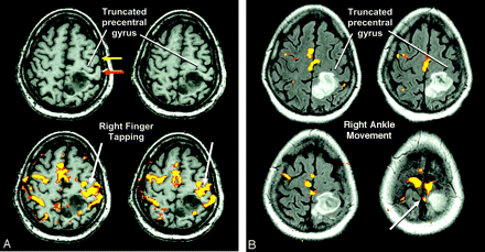 Fig 1.