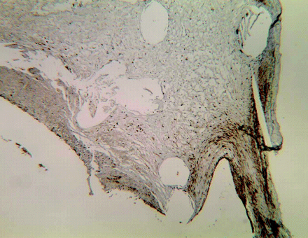 Fig 2.