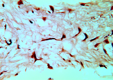 Fig 3.