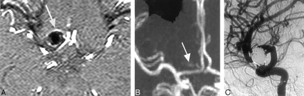 Fig 1.