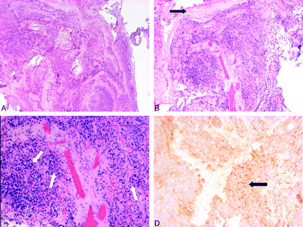 Fig 4.