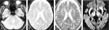 Fig 2.