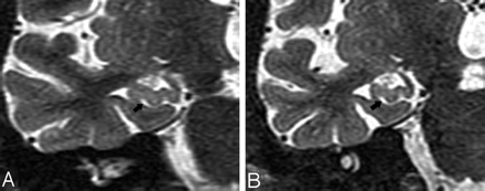 Fig 5.