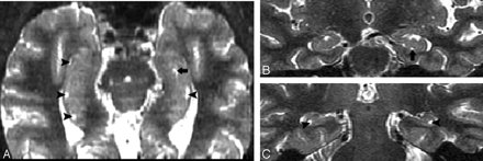 Fig 6.