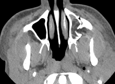 Fig 1.