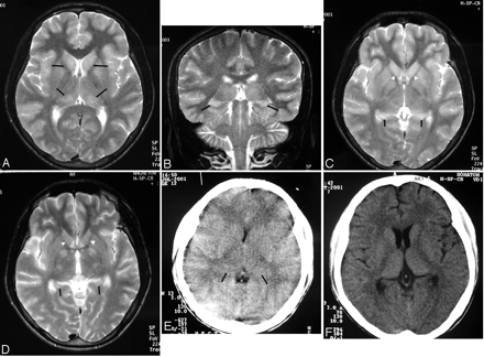 Fig 2.