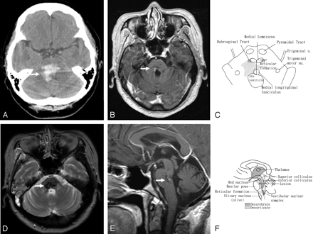   Fig 1. 