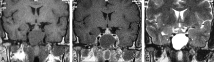 Fig 1.
