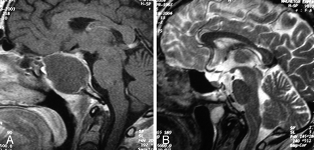 Fig 2.