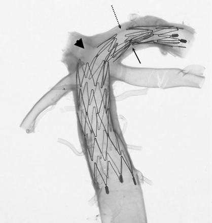 Fig 4.