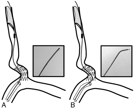 Fig 2.