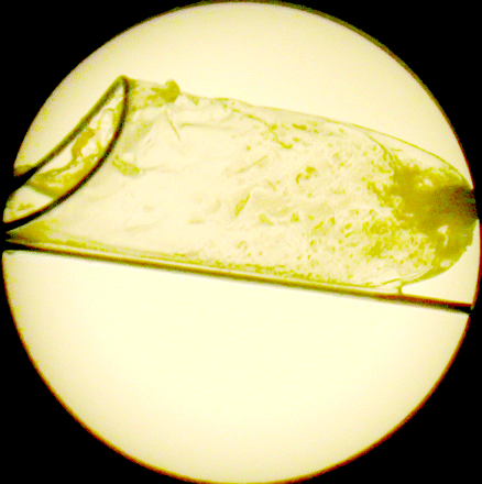 Fig 3.