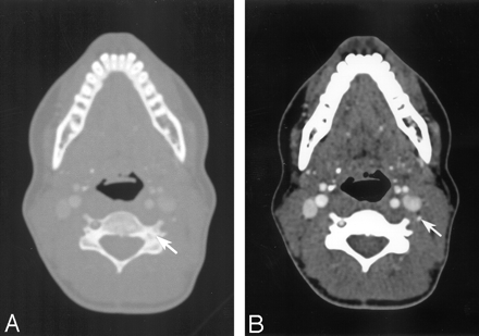 Fig 2.