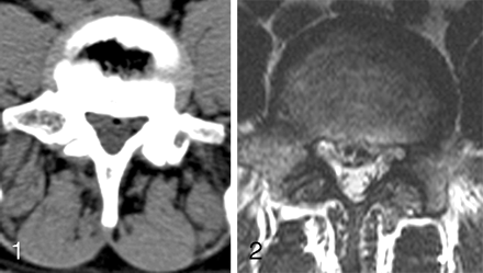 Fig 2.