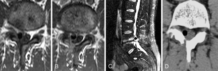 Fig 3.