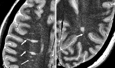 Fig 1.