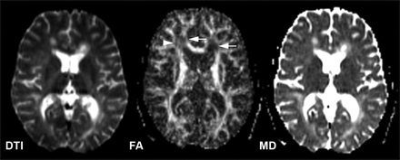 Fig 5.