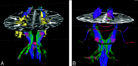 Fig 6.