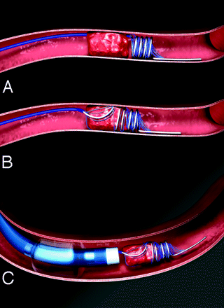 Fig 1.