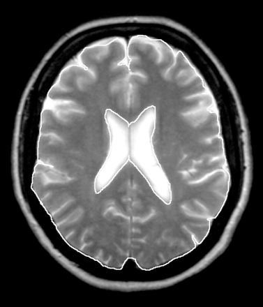 Fig 1.