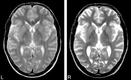 Fig 3.