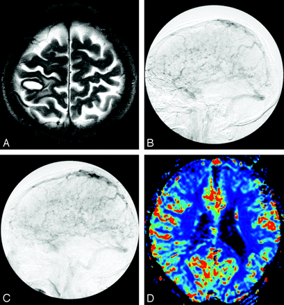 Fig 3.