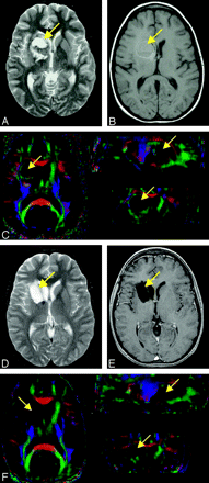 Fig 13.